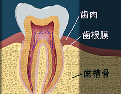 歯周病とは